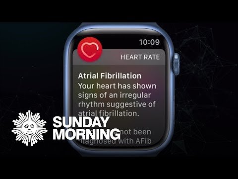 Tracking your health data through wearable devices - CBS Sunday Morning thumbnail